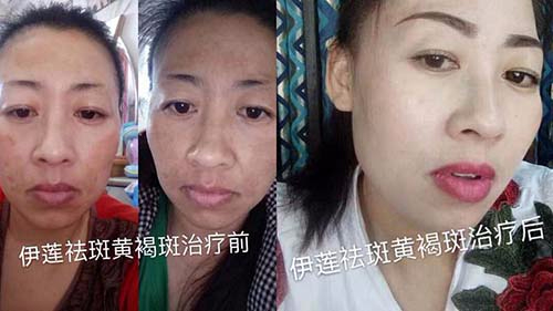 純中藥?kù)畎叽砑用苏猩? title=